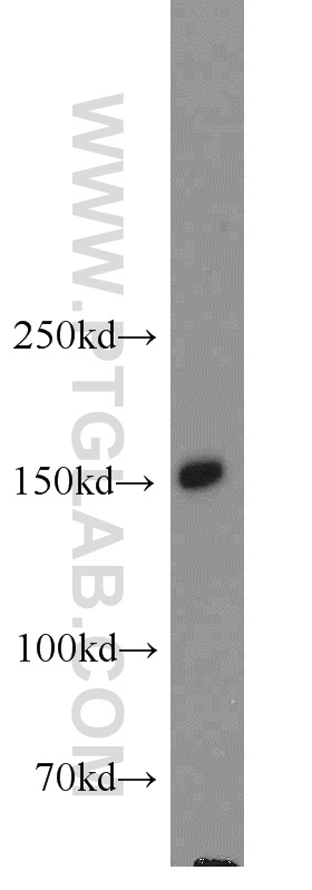 human testis tissue were subjected to SDS PAGE followed by western blot with 22026-1-AP(NPHP3 antibody) at dilution of 1:500