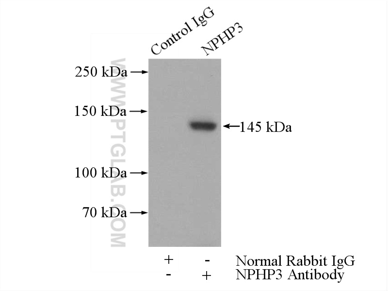 IP Result of anti-NPHP3 (IP:22026-1-AP, 4ug; Detection:22026-1-AP 1:1000) with mouse testis tissue lysate 4000ug.