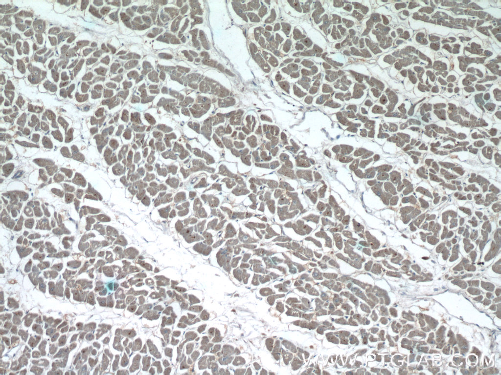 Immunohistochemistry of paraffin-embedded human heart tissue slide using 22026-1-AP( NPHP3 Antibody) at dilution of 1:50 (under 10x lens)