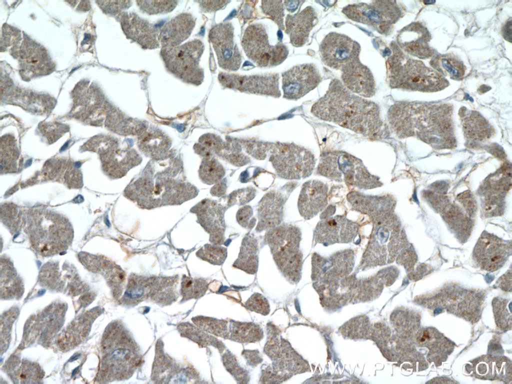 Immunohistochemistry of paraffin-embedded human heart tissue slide using 22026-1-AP( NPHP3 Antibody) at dilution of 1:50 (under 40x lens)