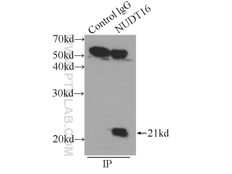 IP Result of anti-NUDT16 (IP:12889-1-AP, 3ug; Detection:12889-1-AP 1:1000) with HEK-293 cells lysate 2400ug.