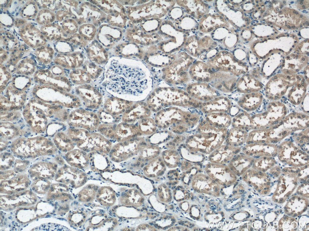 Immunohistochemistry of paraffin-embedded human kidney tissue slide using 12889-1-AP( NUDT16 Antibody) at dilution of 1:50 (under 10x lens)