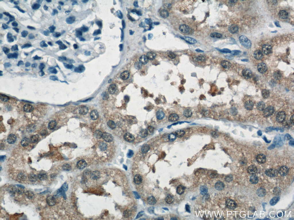 Immunohistochemistry of paraffin-embedded human kidney tissue slide using 12889-1-AP( NUDT16 Antibody) at dilution of 1:50 (under 40x lens)