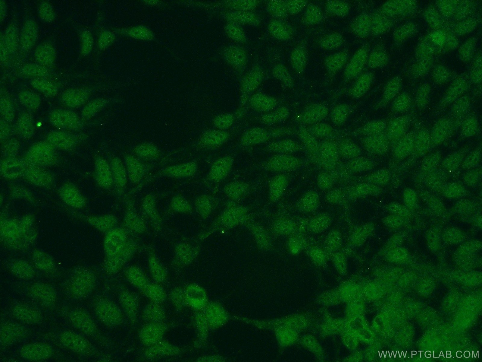 Immunofluorescent analysis of HEK-293 cells using 12889-1-AP( NUDT16 Antibody) at dilution of 1:50 and Alexa Fluor 488-congugated AffiniPure Goat Anti-Rabbit IgG(H+L)
