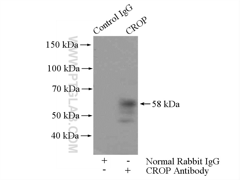 IP Result of anti-CROP (IP:14504-1-AP, 4ug; Detection:14504-1-AP 1:500) with HepG2 cells lysate 3600ug.