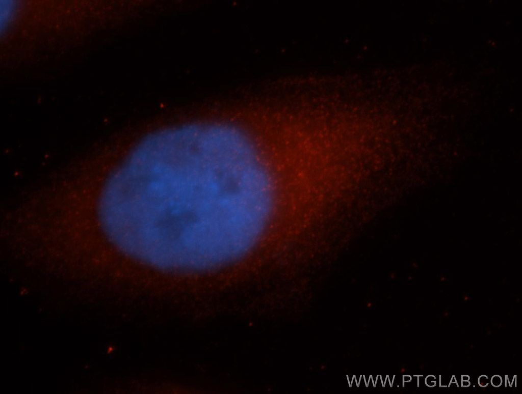 Immunofluorescent analysis of MCF-7 cells, using PNRC2 antibody 10223-2-AP at 1:50 dilution and Rhodamine-labeled goat anti-rabbit IgG (red). Blue pseudocolor = DAPI (fluorescent DNA dye).