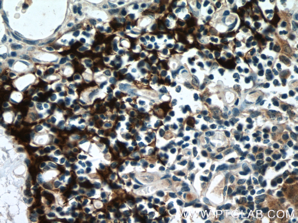 Immunohistochemistry of paraffin-embedded human thymus tissue slide using 55143-1-AP( PSMB11 Antibody) at dilution of 1:200 (under 40x lens). heat mediated antigen retrieved with Tris-EDTA buffer(pH9).