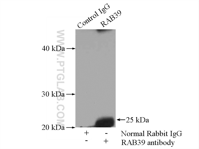 IP Result of anti-RAB39 (IP:13355-1-AP, 4ug; Detection:13355-1-AP 1:500) with mouse brain tissue lysate 4000ug.