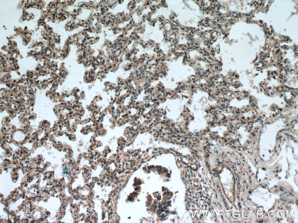 Immunohistochemical of paraffin-embedded human lung using 14448-1-AP(RABGGTA antibody) at dilution of 1:100 (under 10x lens)