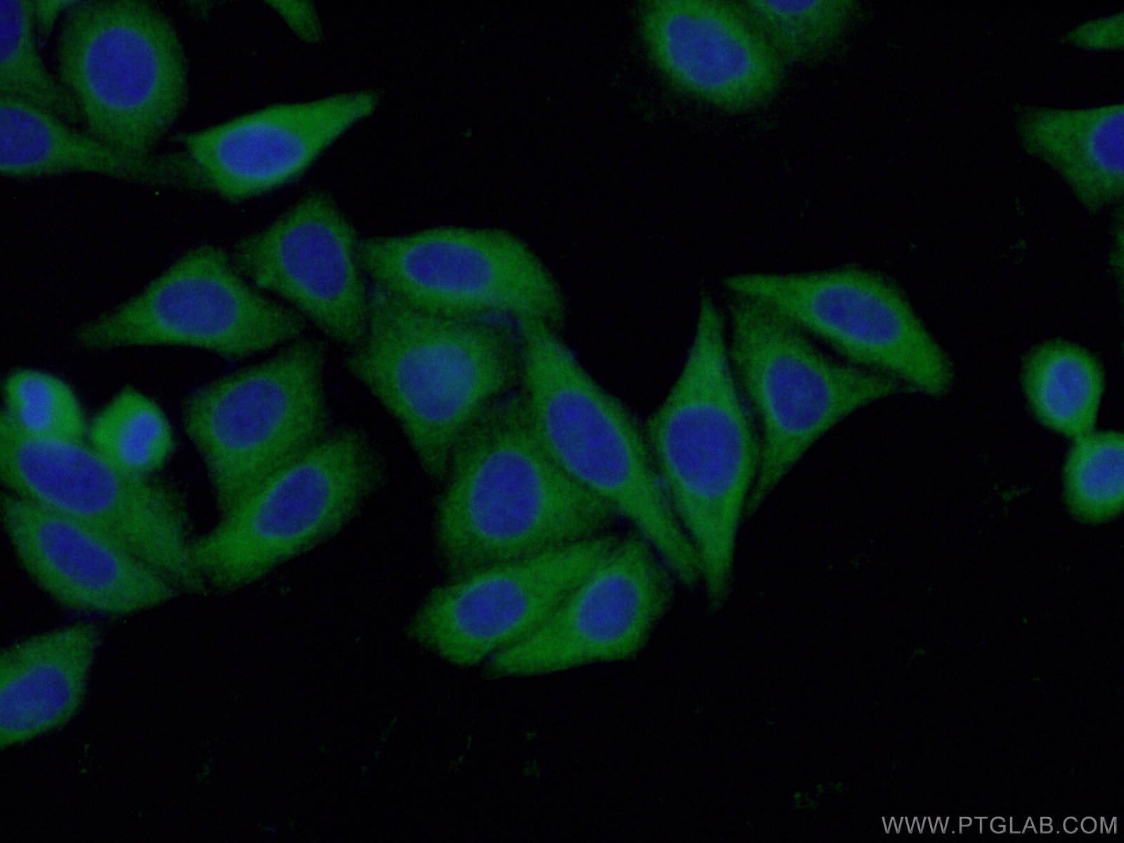 Immunofluorescent analysis of ( -20℃ Ethanol) fixed HepG2 cells using 14448-1-AP (RABGGTA antibody) at dilution of 1:50 and Alexa Fluor 488-congugated AffiniPure Goat Anti-Rabbit IgG(H+L)