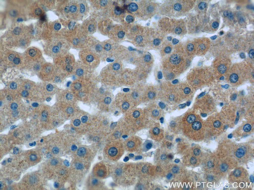 Immunohistochemistry of paraffin-embedded human liver tissue slide using 25750-1-AP( RAPH1 Antibody) at dilution of 1:50 (under 40x lens)
