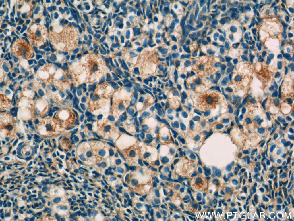 Immunohistochemistry of paraffin-embedded human ovary tissue slide using 25750-1-AP( RAPH1 Antibody) at dilution of 1:50 (under 40x lens)