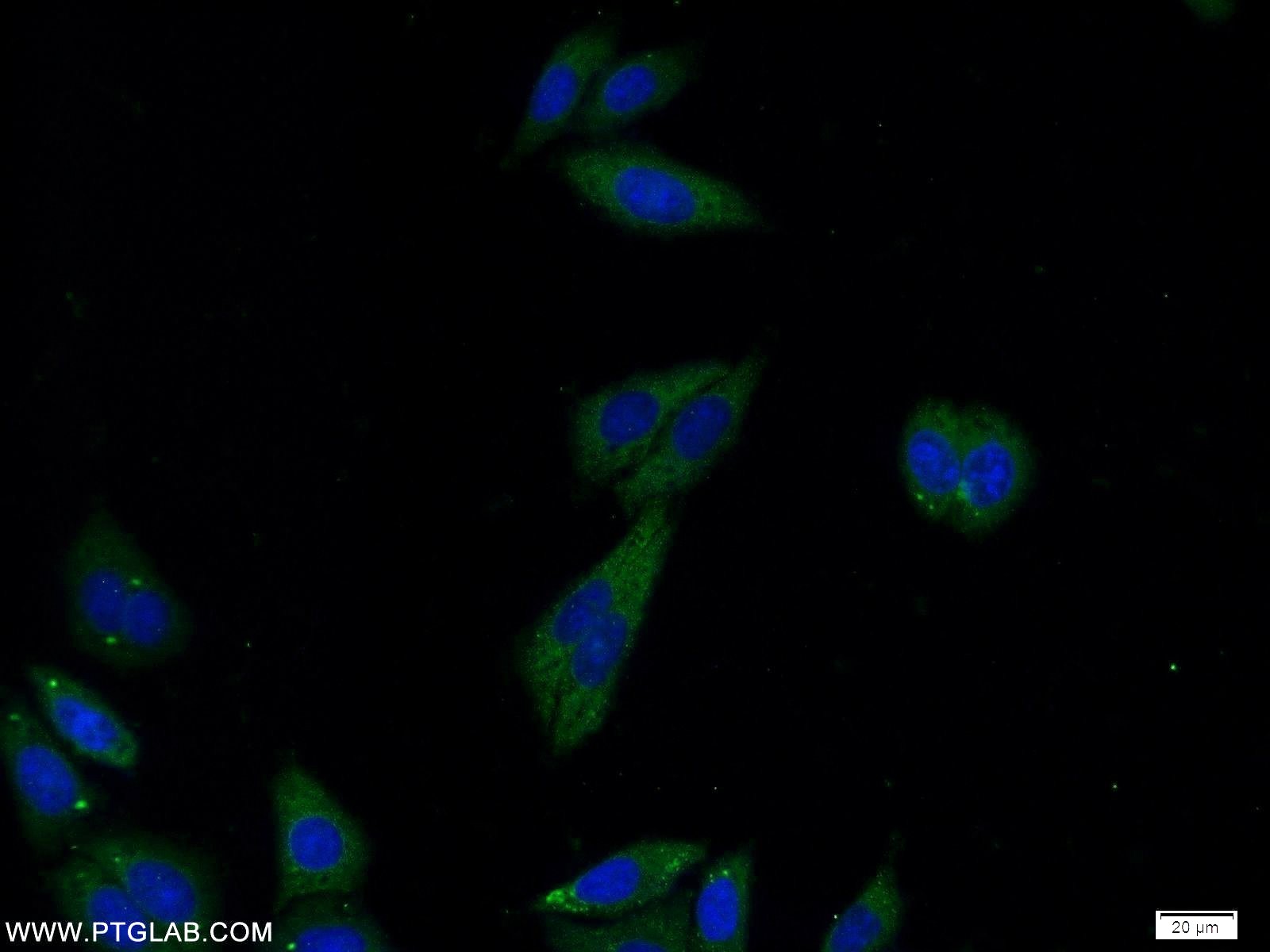 Immunofluorescent analysis of HepG2 cells using 25750-1-AP( RAPH1 Antibody) at dilution of 1:25 and Alexa Fluor 488-congugated AffiniPure Goat Anti-Rabbit IgG(H+L)
