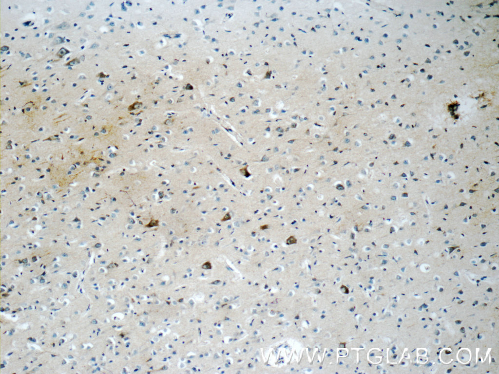 Immunohistochemistry of paraffin-embedded human brain tissue slide using 10687-1-AP( RERG Antibody) at dilution of 1:50 (under 10x lens)