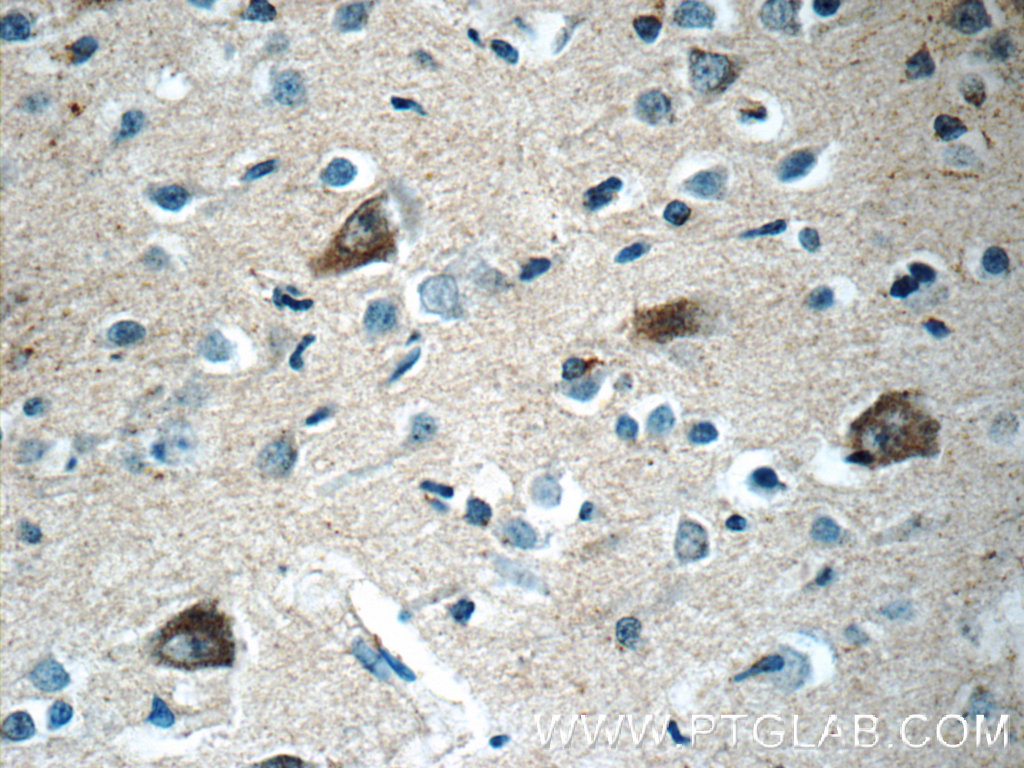 Immunohistochemistry of paraffin-embedded human brain tissue slide using 10687-1-AP( RERG Antibody) at dilution of 1:50 (under 40x lens)