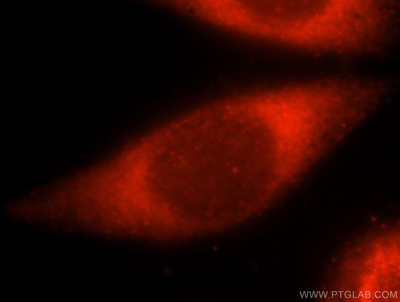 Immunofluorescent analysis of Hela cells, using RIBC2 antibody 15272-1-AP at 1:25 dilution and Rhodamine-labeled goat anti-rabbit IgG (red).