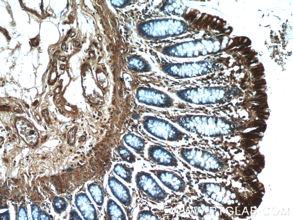 Immunohistochemistry of paraffin-embedded human colon tissue slide using 25803-1-AP( RMND5B Antibody) at dilution of 1:50 (under 10x lens)