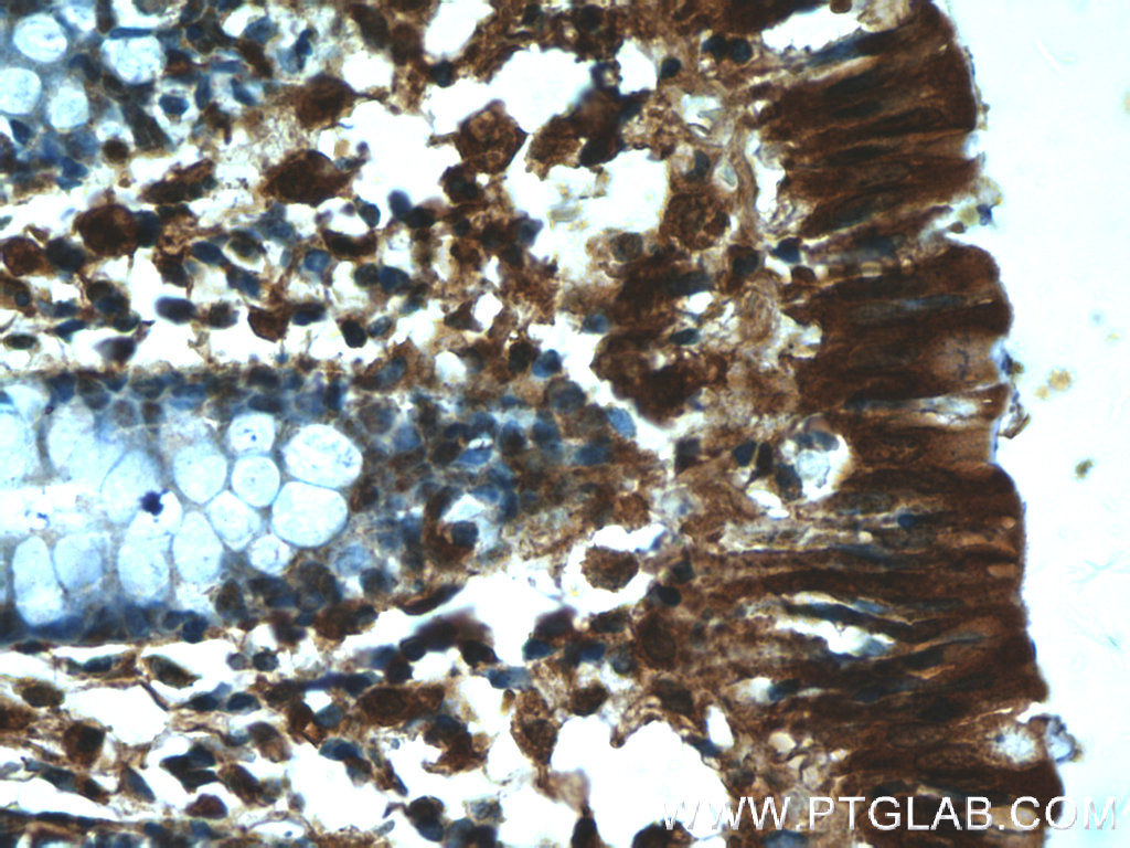 Immunohistochemistry of paraffin-embedded human colon tissue slide using 25803-1-AP( RMND5B Antibody) at dilution of 1:50 (under 40x lens)