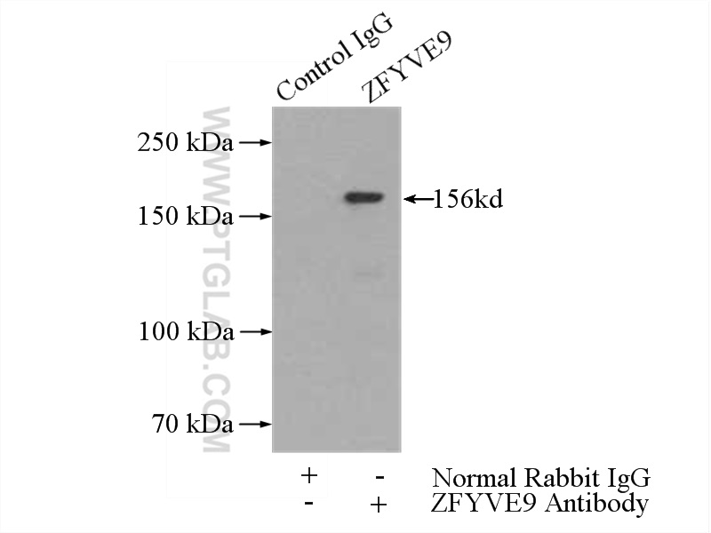 IP Result of anti-ZFYVE9 (IP:14821-1-AP, 5ug; Detection:14821-1-AP 1:500) with mouse brain tissue lysate 4000ug.