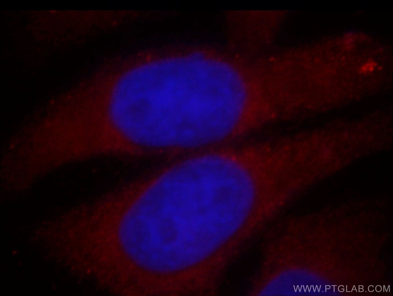 Immunofluorescent analysis of HepG2 cells, using ZFYVE9 antibody 14821-1-AP at 1:25 dilution and Rhodamine-labeled goat anti-rabbit IgG (red). Blue pseudocolor = DAPI (fluorescent DNA dye).