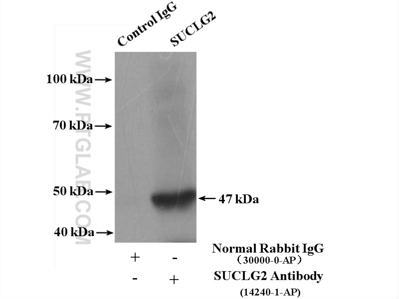 IP Result of anti-SUCLG2 (IP:14240-1-AP, 4ug; Detection:14240-1-AP 1:600) with mouse kidney tissue lysate 4800ug.