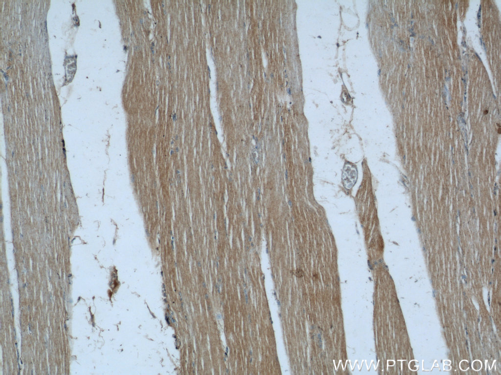 Immunohistochemical of paraffin-embedded human skeletal muscle using 20735-1-AP(SYNM antibody) at dilution of 1:50 (under 10x lens)