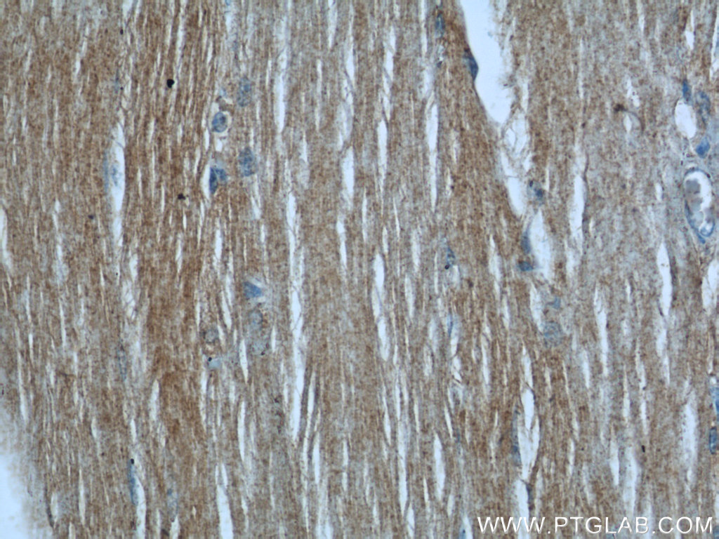 Immunohistochemical of paraffin-embedded human skeletal muscle using 20735-1-AP(SYNM antibody) at dilution of 1:50 (under 40x lens)