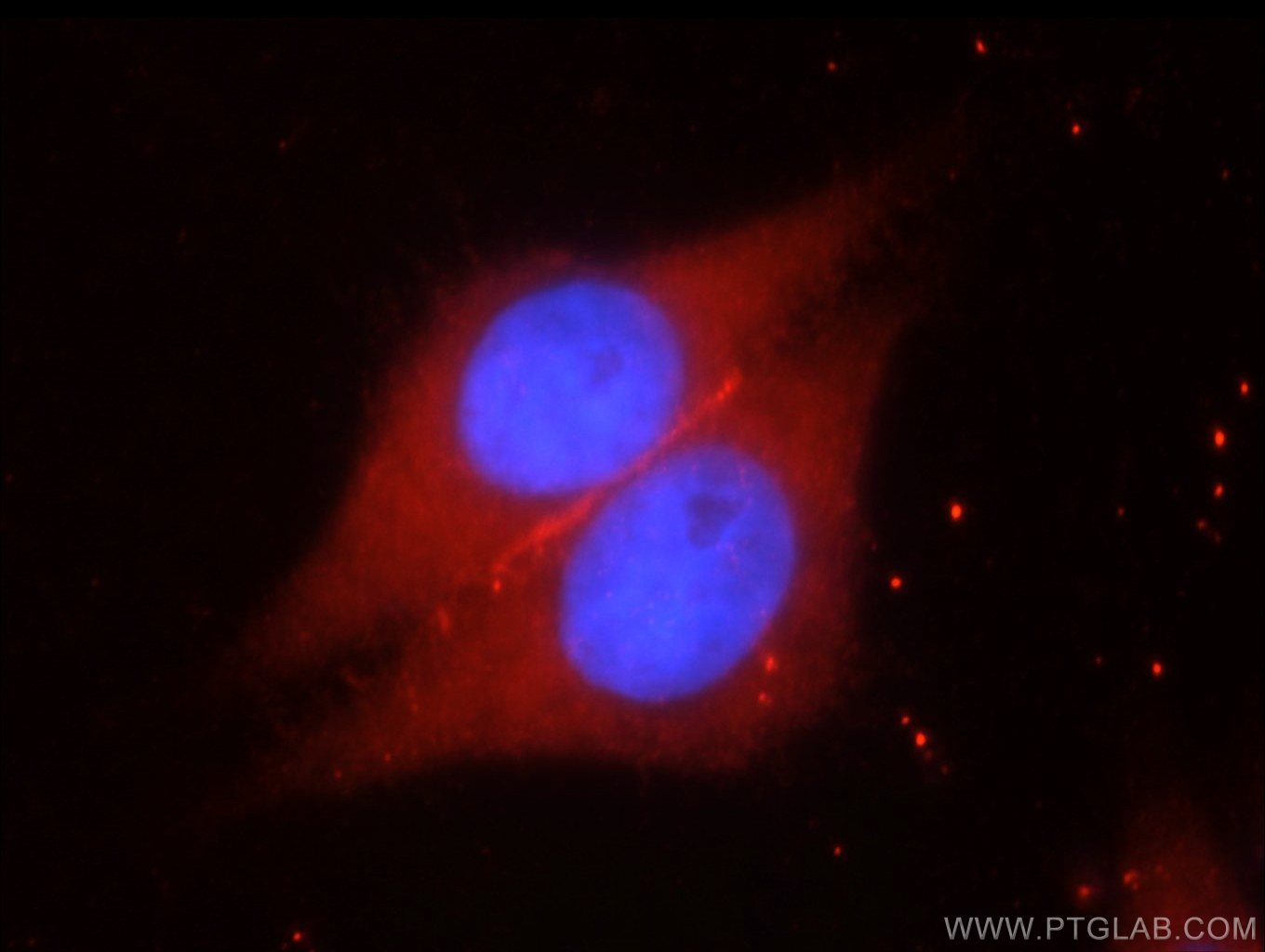 Immunofluorescent analysis of HeLa cells using 20735-1-AP( SYNM Antibody) at dilution of 1:25 and Rhodamine-Goat anti-Rabbit IgG