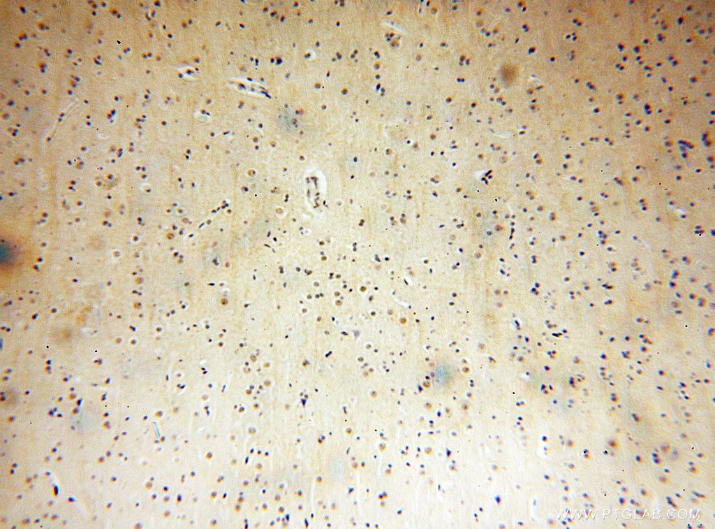 Immunohistochemical of paraffin-embedded human brain using 17372-1-AP(TEX10 antibody) at dilution of 1:200 (under 10x lens)