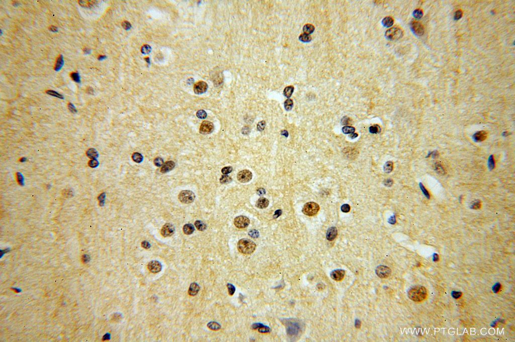 Immunohistochemical of paraffin-embedded human brain using 17372-1-AP(TEX10 antibody) at dilution of 1:200 (under 40x lens)