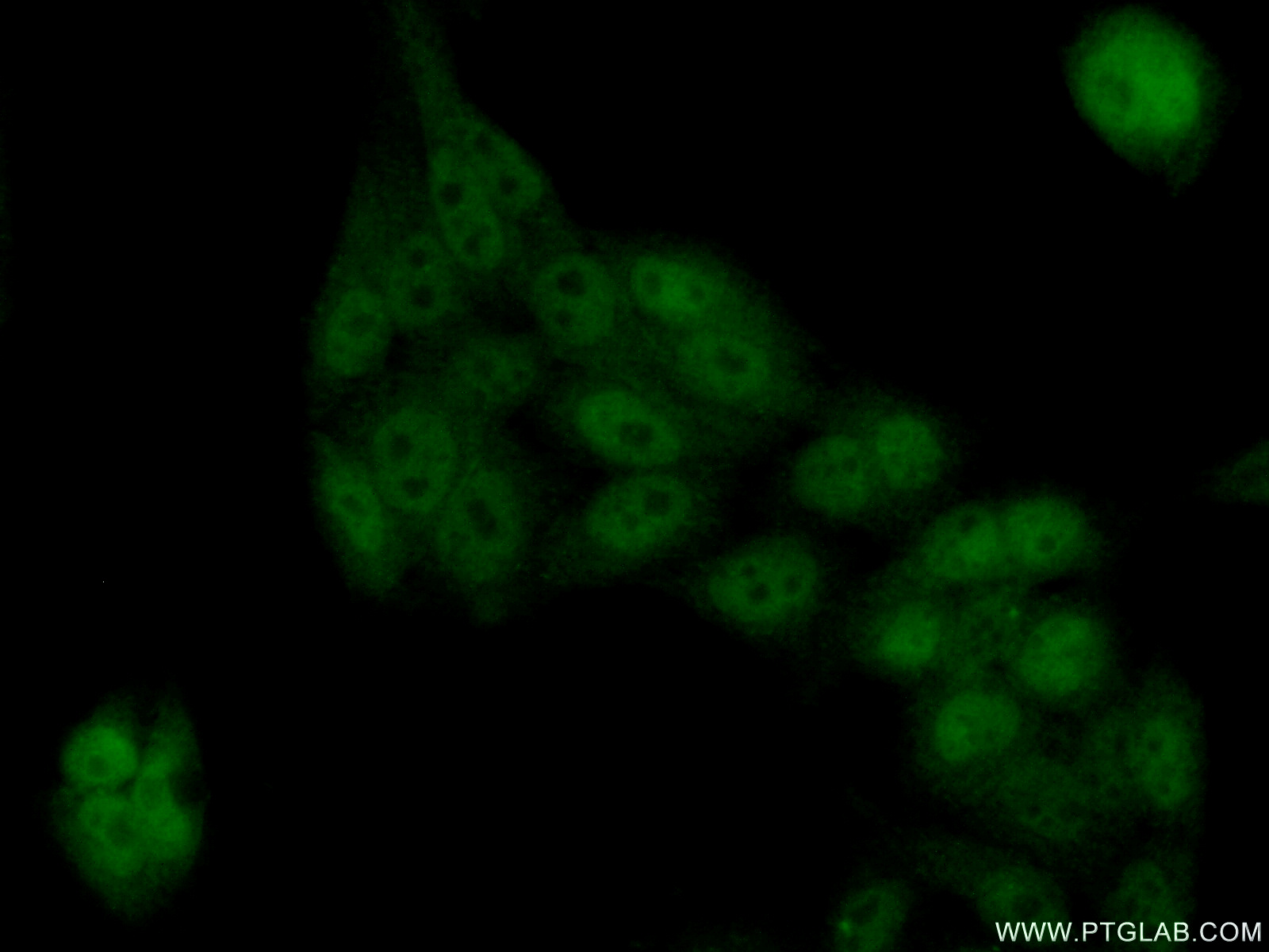 Immunofluorescent analysis of ( 10% Formaldehyde ) fixed HeLa cells using 17372-1-AP( TEX10 Antibody) at dilution of 1:50 and Alexa Fluor 488-congugated AffiniPure Goat Anti-Rabbit IgG(H+L)