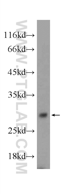 mouse testis tissue were subjected to SDS PAGE followed by western blot with 24429-1-AP( C1orf223 Antibody) at dilution of 1:600