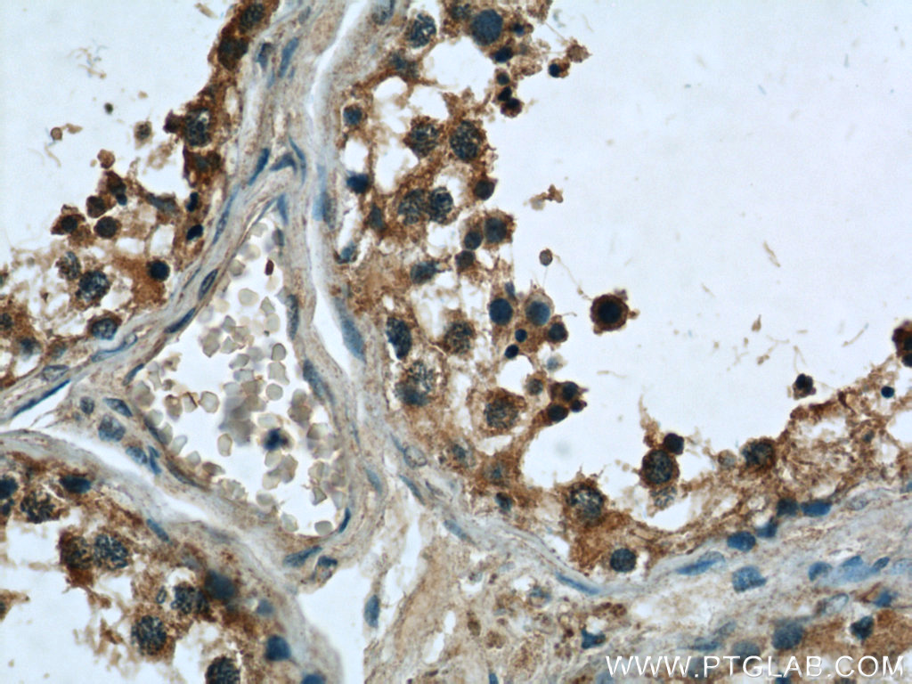 Immunohistochemistry of paraffin-embedded human testis slide using 24429-1-AP( C1orf223 Antibody) at dilution of 1:50 (under 40x lens)