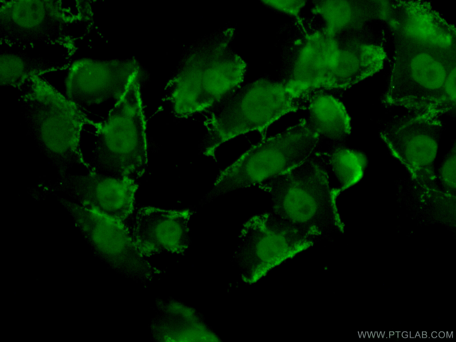 Immunofluorescent analysis of ( 4% PFA ) fixed A375 cells using 25829-1-AP( TFAP2E Antibody) at dilution of 1:50 and Alexa Fluor 488-congugated AffiniPure Goat Anti-Rabbit IgG(H+L)