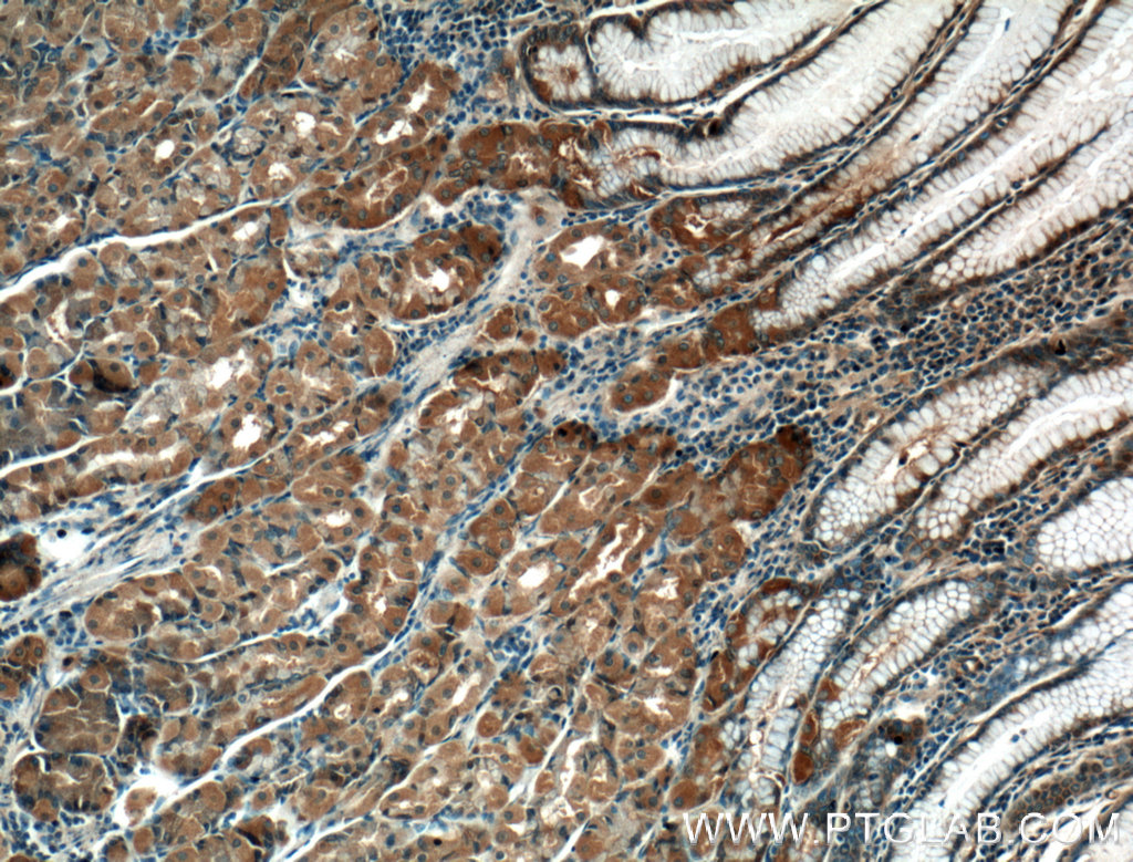 Immunohistochemistry of paraffin-embedded human stomach tissue slide using 21897-1-AP( THAP10 Antibody) at dilution of 1:200 (under 10x lens).