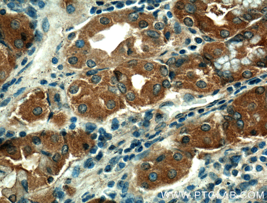 Immunohistochemistry of paraffin-embedded human stomach tissue slide using 21897-1-AP( THAP10 Antibody) at dilution of 1:200 (under 40x lens).