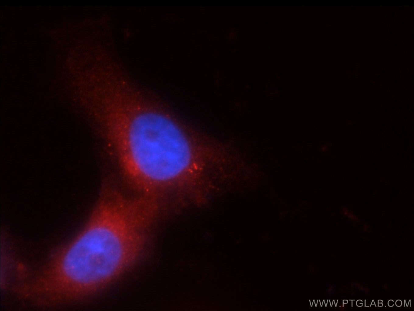 Immunofluorescent analysis of SH-SY5Y cells using 55111-1-AP( TRPM1 Antibody) at dilution of 1:25 and Rhodamine-Goat anti-Rabbit IgG