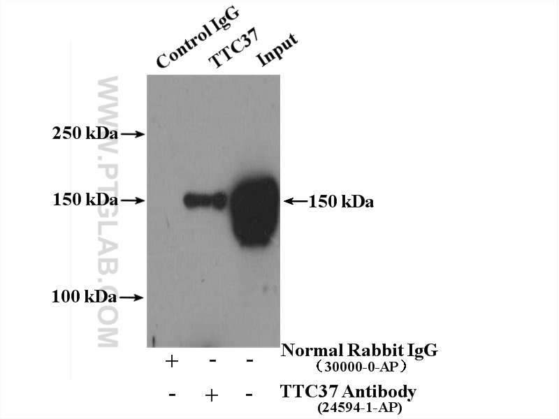 IP Result of anti-TTC37 (IP:24594-1-AP, 4ug; Detection:24594-1-AP 1:300) with mouse testis tissue lysate 4000ug.