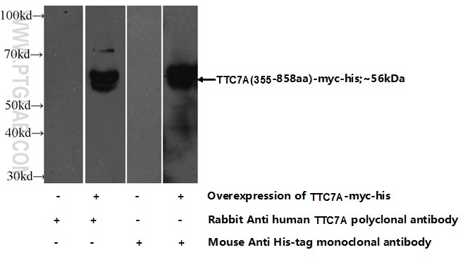 Transfected HEK-293 cells were subjected to SDS PAGE followed by western blot with 21600-1-AP( TTC7A Antibody) at dilution of 1:500