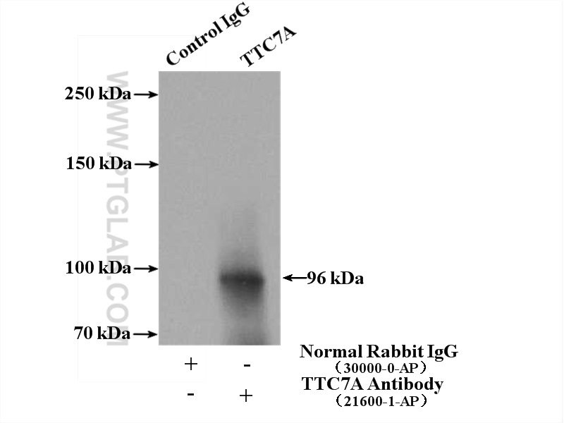 IP Result of anti-TTC7A (IP:21600-1-AP, 4ug; Detection:21600-1-AP 1:300) with K-562 cells lysate 4000ug.