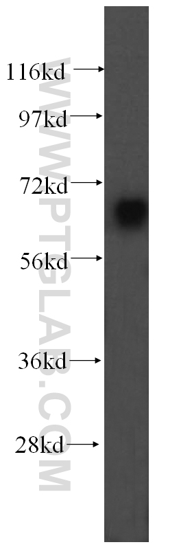 human brain tissue were subjected to SDS PAGE followed by western blot with 16400-1-AP(UBQLNL antibody) at dilution of 1:500