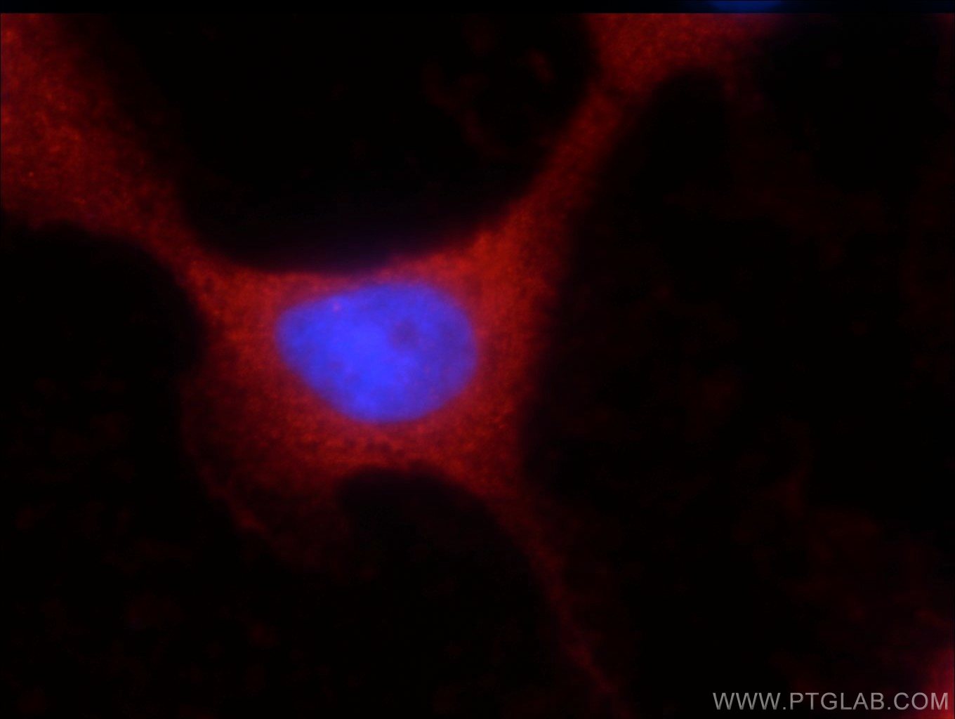Immunofluorescent analysis of A431 cells using 16400-1-AP( UBQLNL Antibody) at dilution of 1:25 and Rhodamine-Goat anti-Rabbit IgG