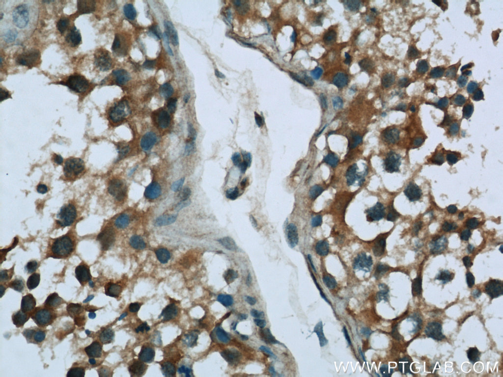 Immunohistochemistry of paraffin-embedded human testis tissue slide using 16400-1-AP( UBQLNL Antibody) at dilution of 1:50