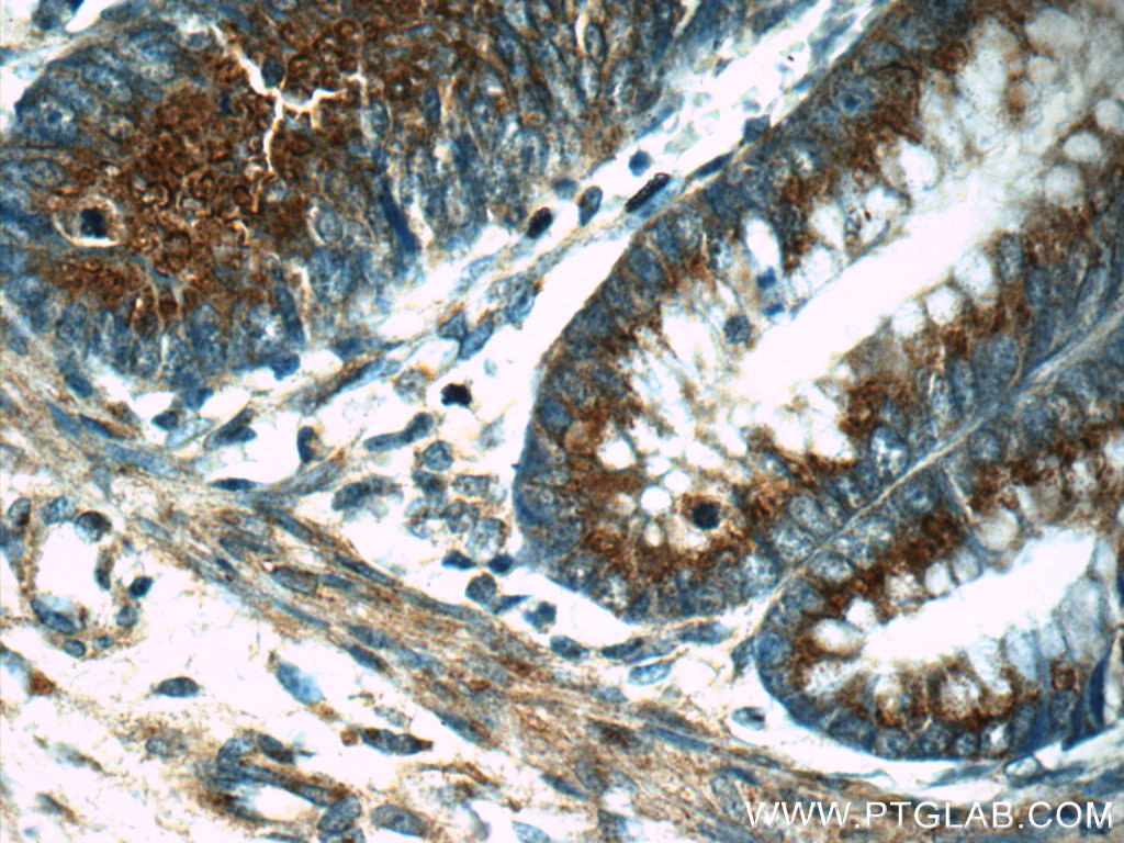 Immunohistochemistry of paraffin-embedded human colon tissue slide using 16400-1-AP( UBQLNL Antibody) at dilution of 1:50