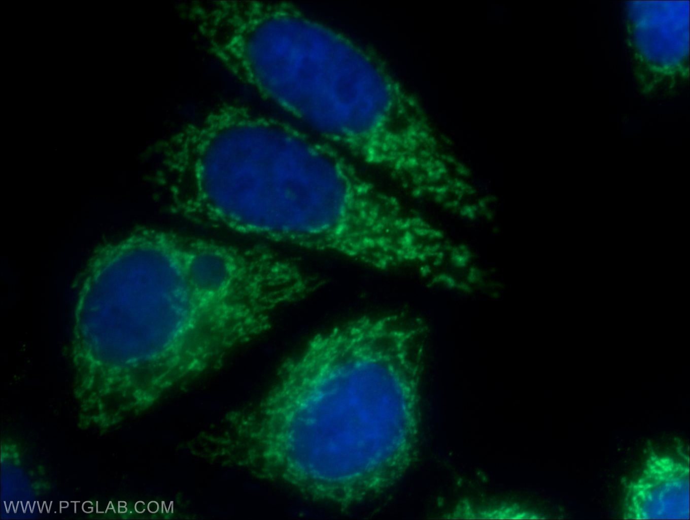 Immunofluorescent analysis of HepG2 cells using 25781-1-AP( C6orf125 Antibody) at dilution of 1:50 and Alexa Fluor 488-congugated AffiniPure Goat Anti-Rabbit IgG(H+L)