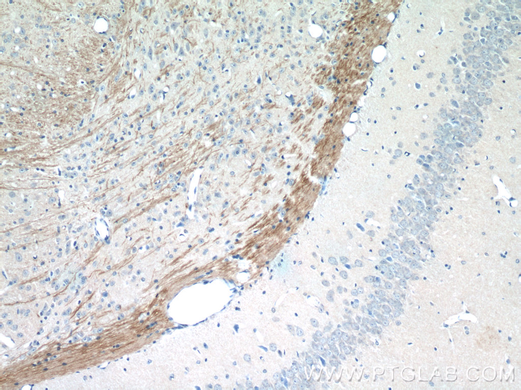 Immunohistochemistry of paraffin-embedded mouse brain tissue slide using 21445-1-AP( DDRGK1 Antibody) at dilution of 1:50 (under 10x lens)