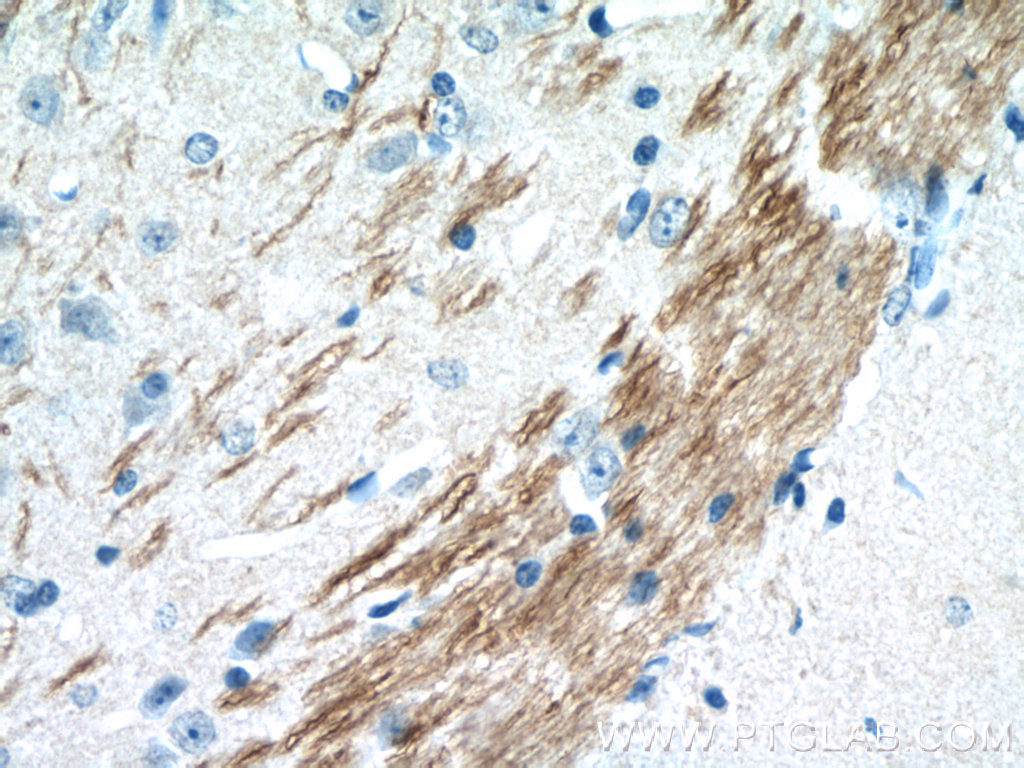 Immunohistochemistry of paraffin-embedded mouse brain tissue slide using 21445-1-AP( DDRGK1 Antibody) at dilution of 1:50 (under 40x lens)