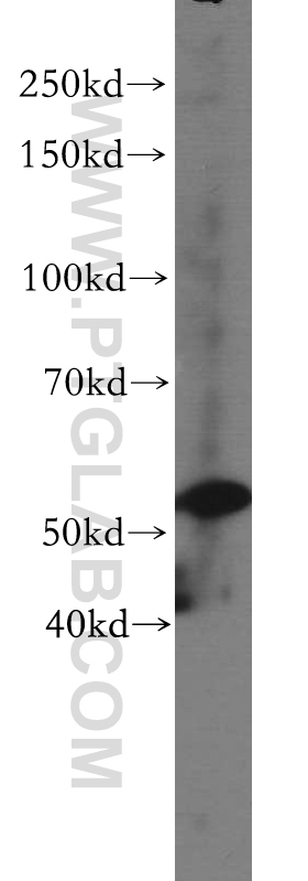 HepG2 cells were subjected to SDS PAGE followed by western blot with 20771-1-AP(C14orf133 antibody) at dilution of 1:300