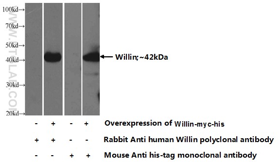 Transfected HEK-293 cells were subjected to SDS PAGE followed by western blot with 21039-1-AP( Willin Antibody) at dilution of 1:1000