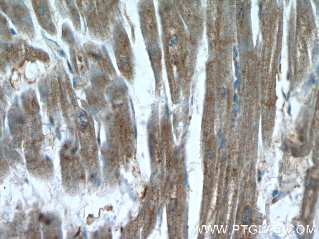 Immunohistochemistry of paraffin-embedded human heart slide using 23108-1-AP( XRN1 Antibody) at dilution of 1:50